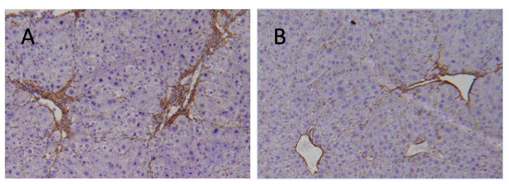 Las hormonas tiroideas disminuyen el desarrollo de la fibrosis