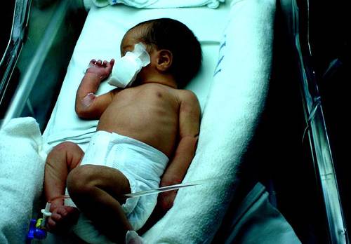 Las madres de niños prematuros corren mayor riesgo de sufrir estrés
