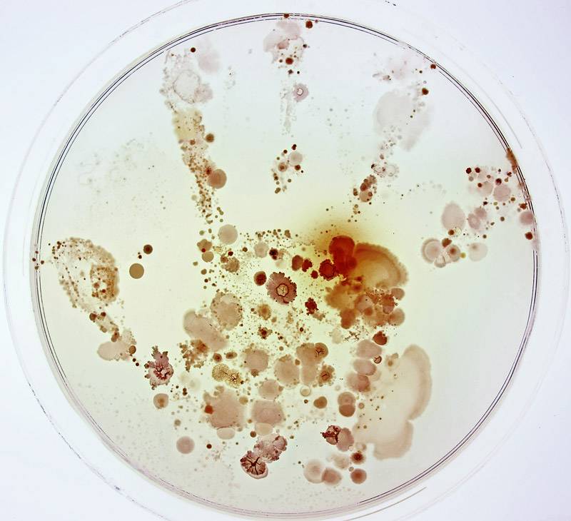 ¿Qué esconde la mano de un niño? De Raúl Rivas González. Couautora: Lorena Celador Lera. Primer premio categoría General de Fotciencia.