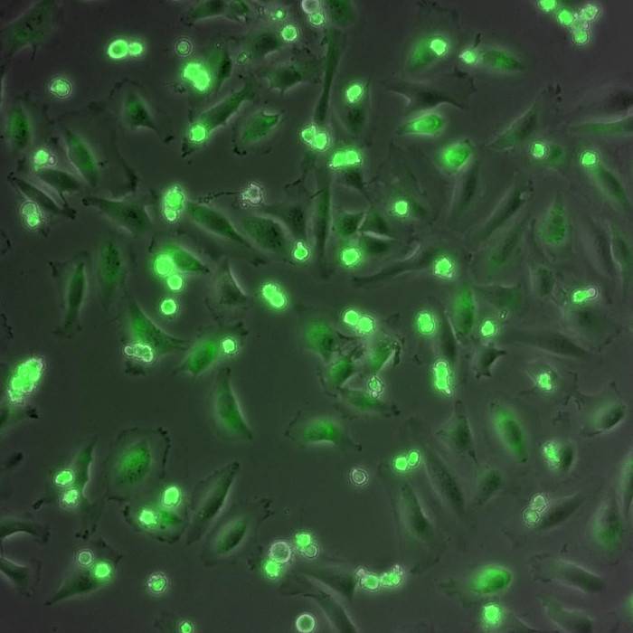 Las mitocondrias de una célula tumoral predicen su sensibilidad a la quimioterapia