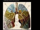 Las mujeres tienen más ingresos hospitalarios por enfermedad pulmonar obstructiva crónica