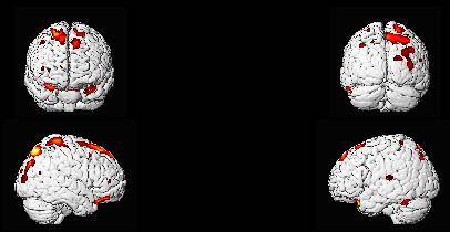 Localizan las capacidades humanas en el cerebro