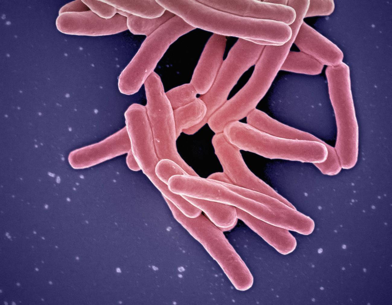 Los casos de tuberculosis infantil aumentan un 26% en la Unión Europea