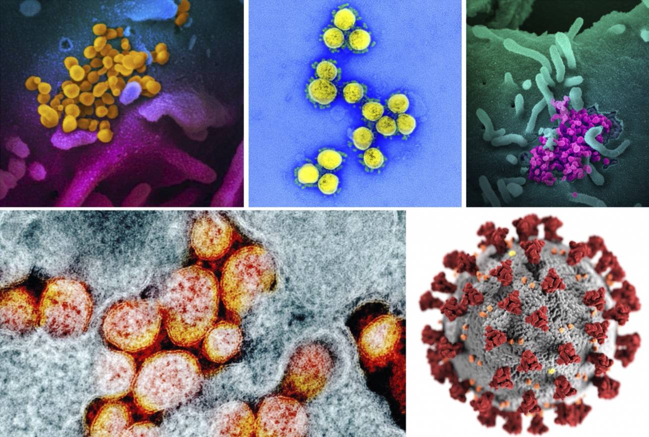Los medios de comunicación han embellecido la imagen del coronavirus