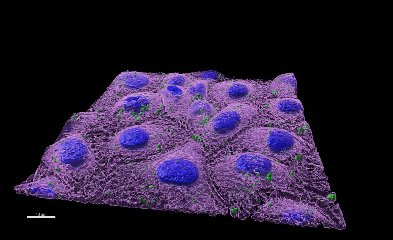 Los nanoplásticos alteran el microbioma intestinal 