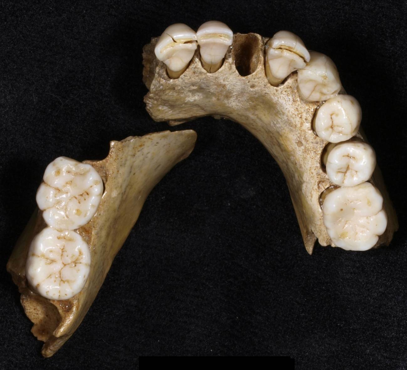 Mandíbula neandertal