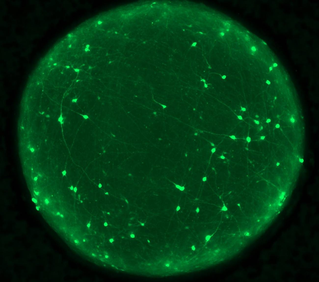 organoide cerebral