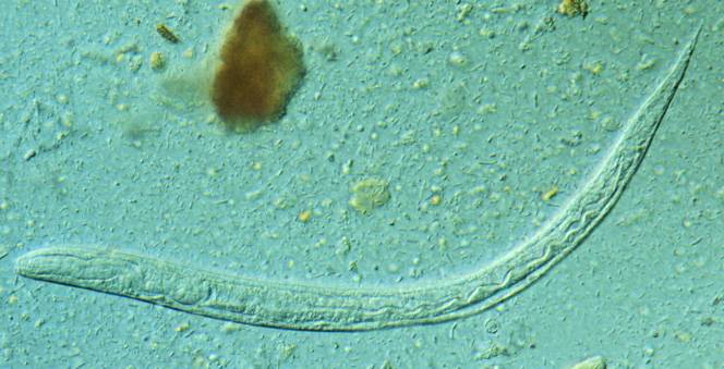 larva de Strongyloides stercoralis