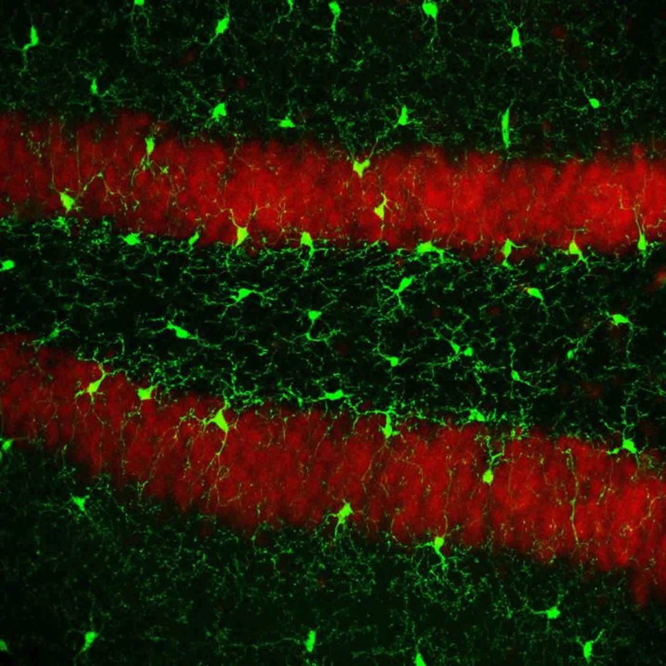 Los ‘vigilantes del cerebro’ se autorrenuevan más rápido de lo que se creía