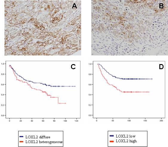 LOXL2, Un nuevo marcador pronóstico en carcinomas escamosos