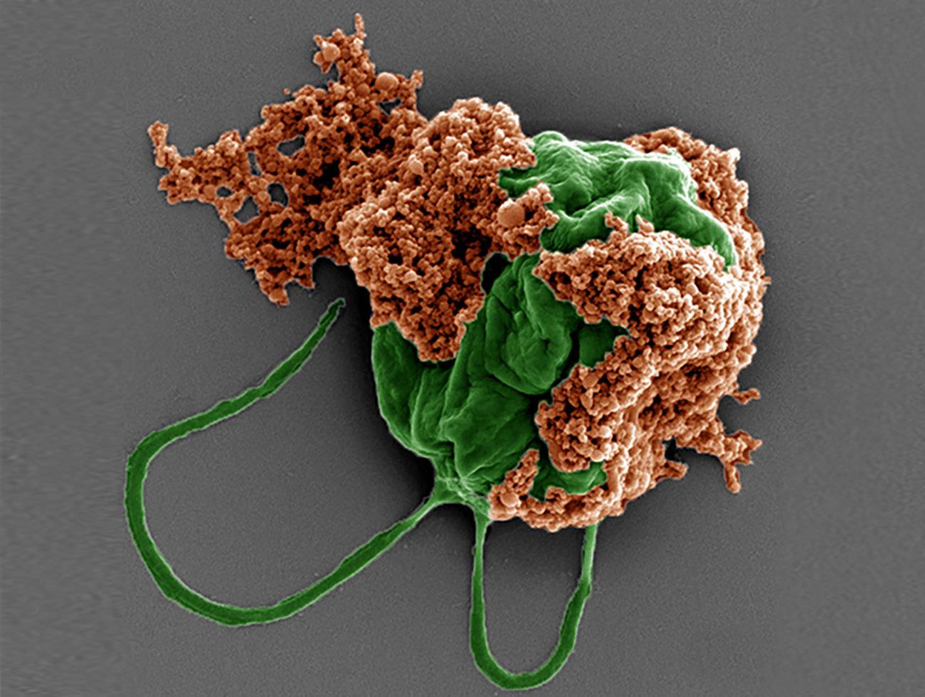 microrobots contra la metástasis en pulmones