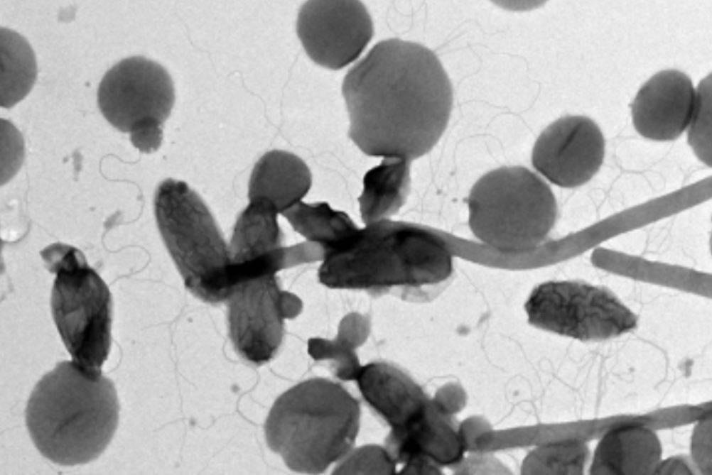 Bacterias y arqueas en fuente termal