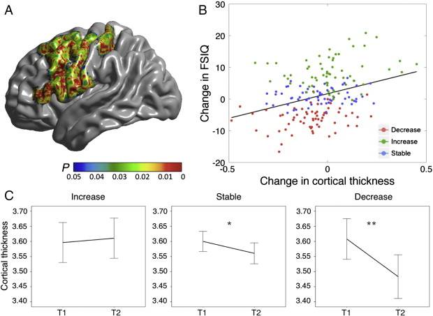 Modificaciones en el espesor de la corteza cerebral se relacionan con cambios en la inteligencia