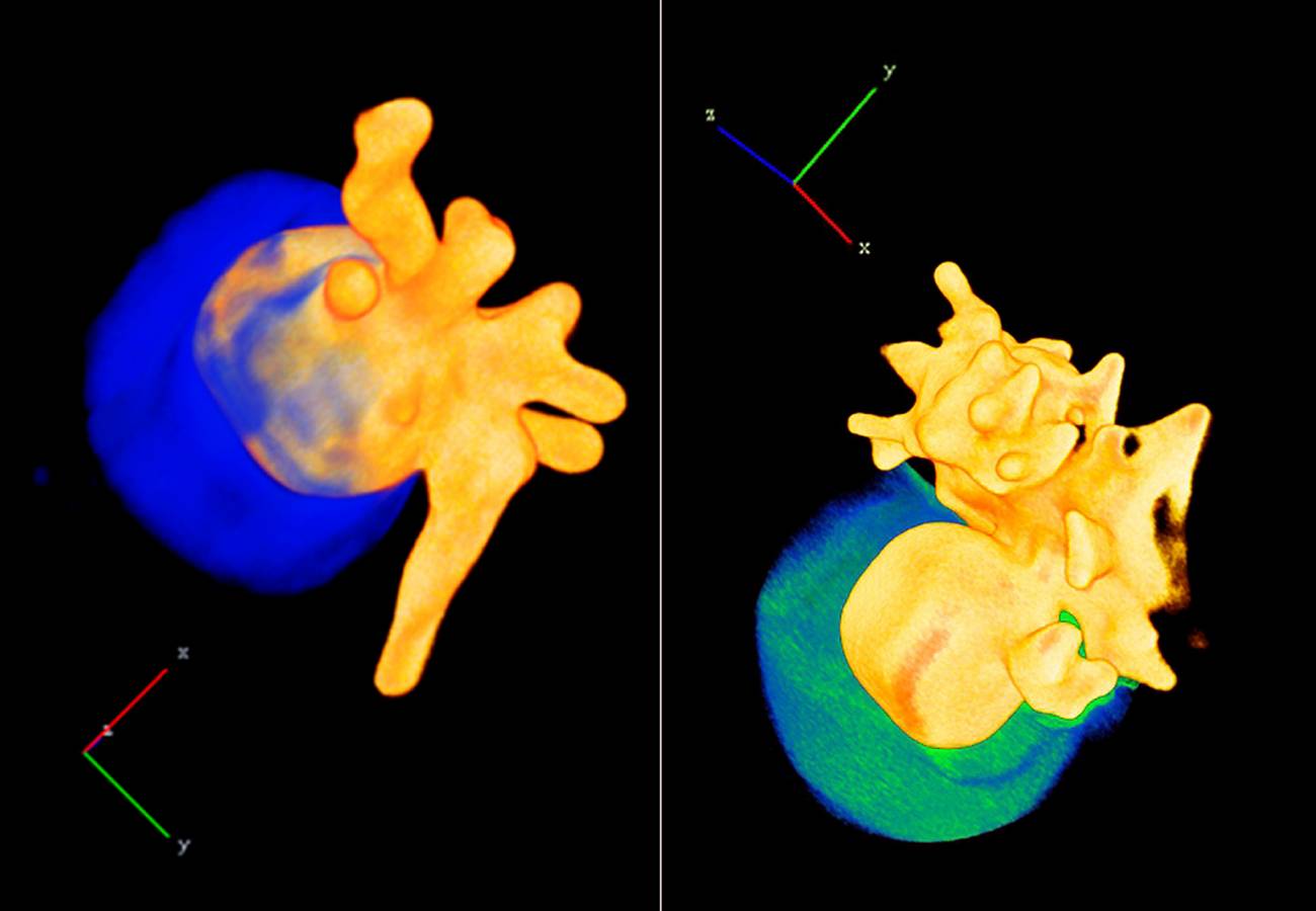 Gold and silica nanostars imitate the two faces of the god Janus