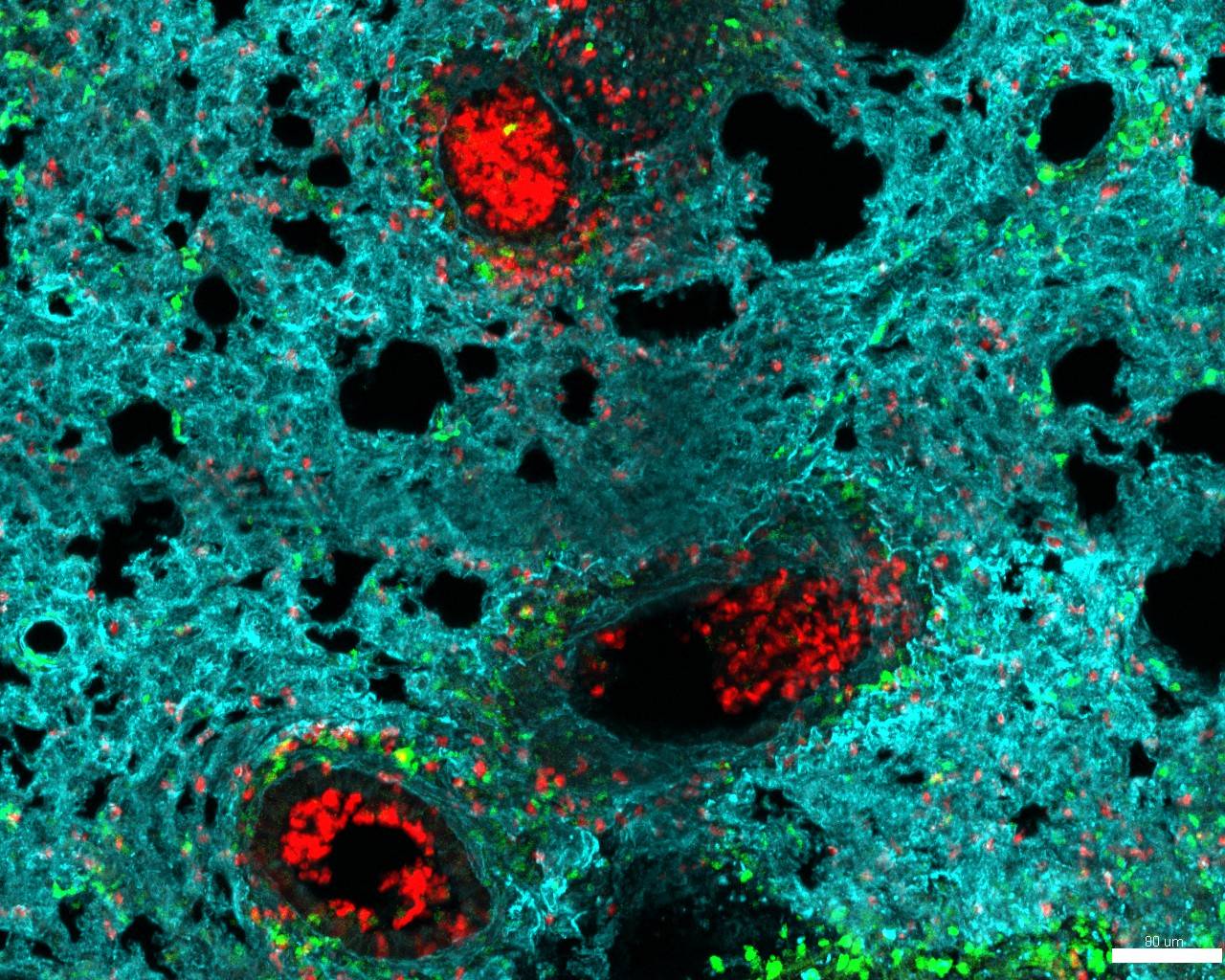 Imagen de neutrófilos en el pulmón