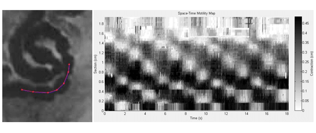 Porción de un intestino con puntos de control y el mapa espacio-temporal del movimiento que se genera con el nuevo sistema de análisis automatizado