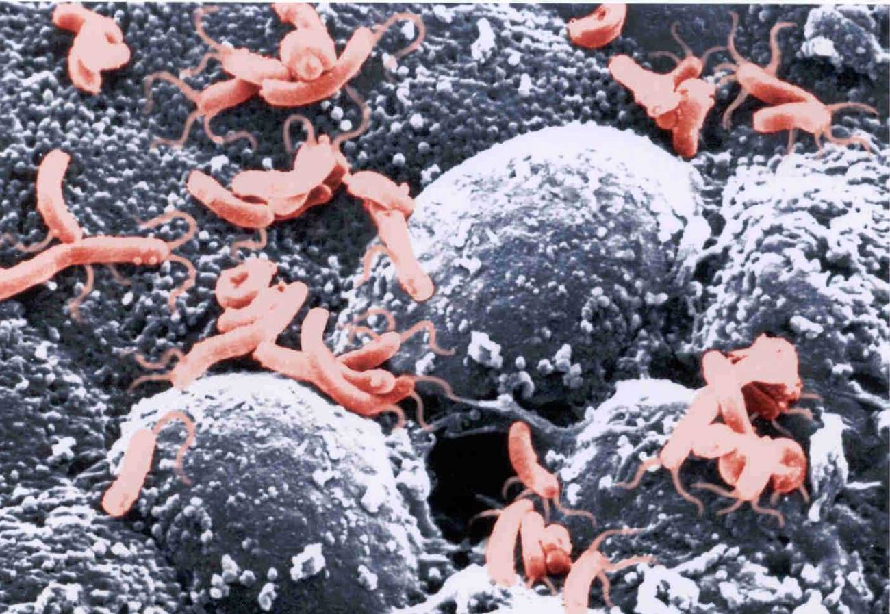 Nuevas fórmulas para combatir infecciones de bacterias resistentes a antibióticos