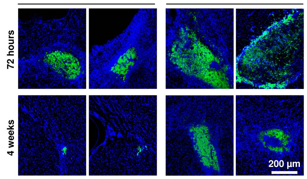 Imágenes de microscopia de fluorescencia mostrando células madre injertadas en el tejido cerebral