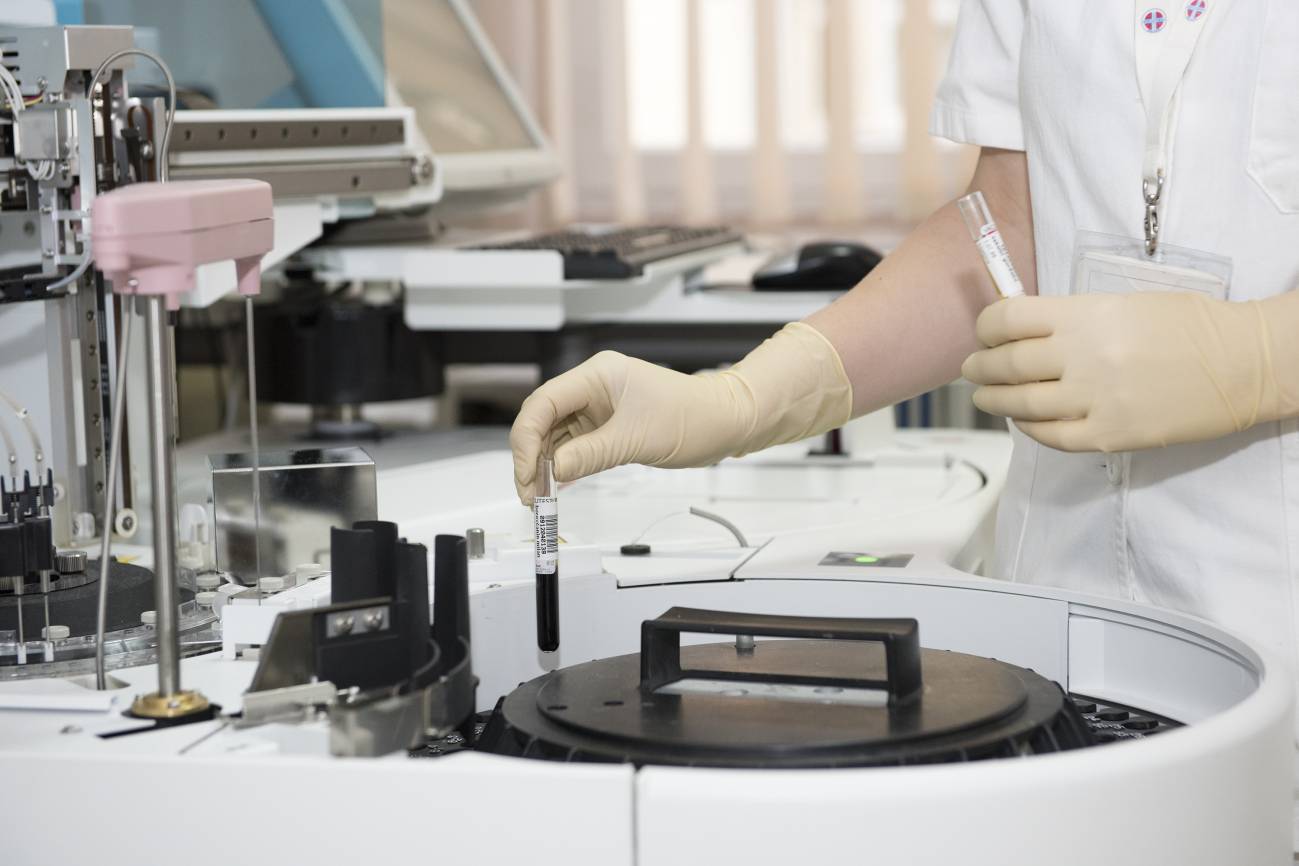Nuevo catalizador para revalorizar la glicerina que genera el biodiésel