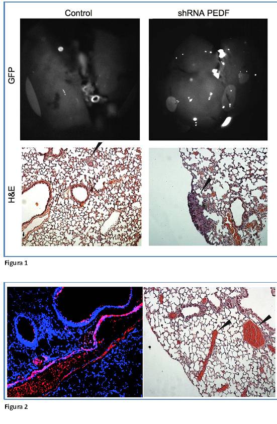Nuevo factor implicado en restringir la progresión maligna del melanoma