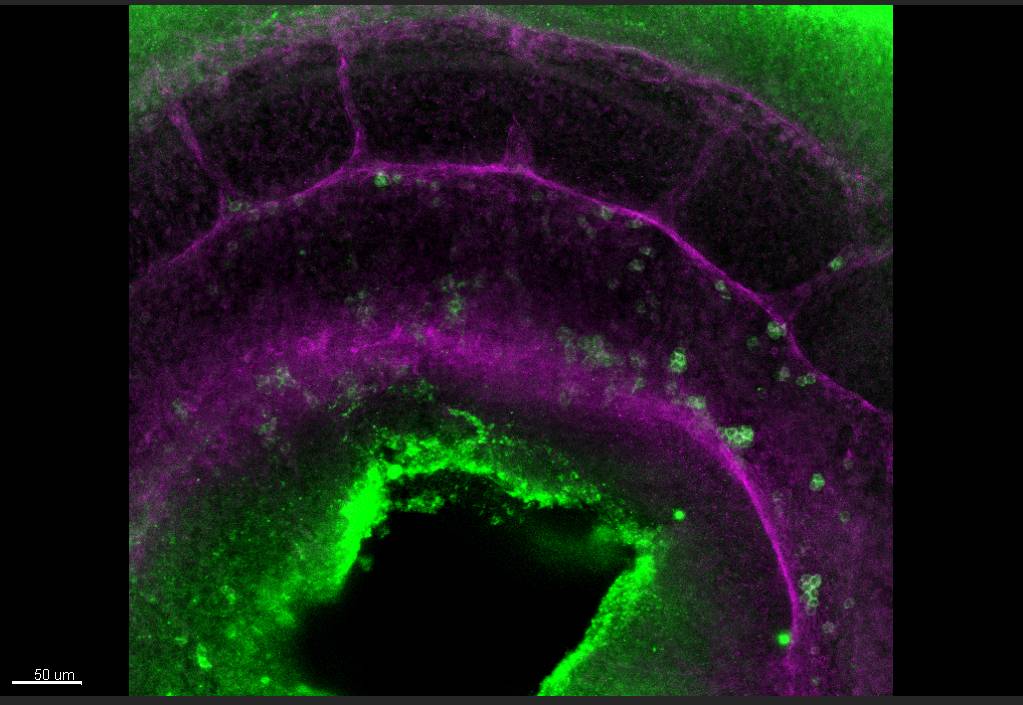 Nuevo paso en la creación de células madre de la sangre en el laboratorio
