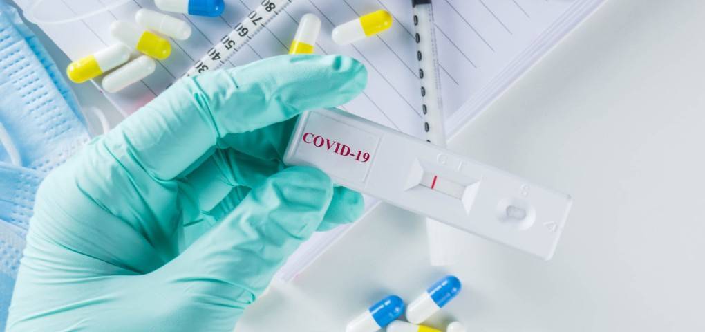 Nuevos test de anticuerpos detectan la inmunidad frente a la COVID-19 con una fiabilidad superior al 98 %