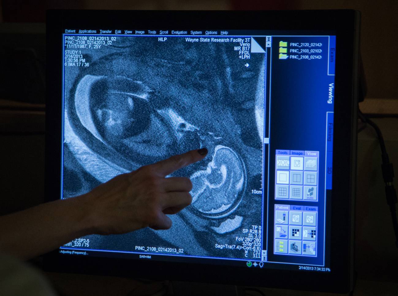 Observan por primera vez cómo se forman las conexiones neuronales en el feto humano