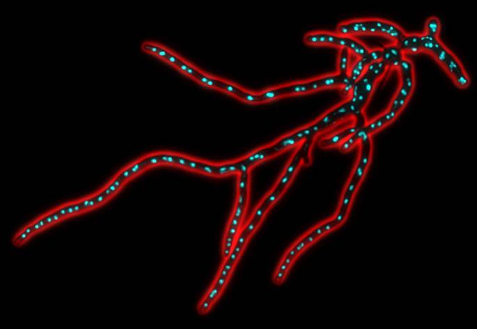 El grupo de investigación de Ingeniería Metabólica de la Universidad de Salamanca diseña cepas del hongo 'Ashbya gossypii' que produce gran cantidad de aceite que también puede servir para la producción de biodiésel