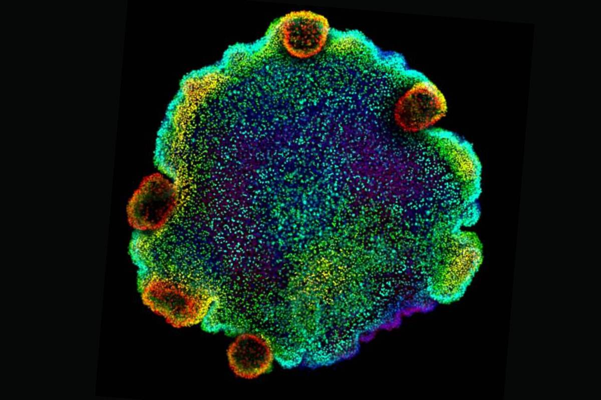 Imagen de microscopía confocal de núcleo de 'Trichoplax sp. H2', una de las cuatro especies de placozoos para las que los autores del estudio crearon un atlas celular. / Centro de Regulación Genómica | Sebastián R. Najle.