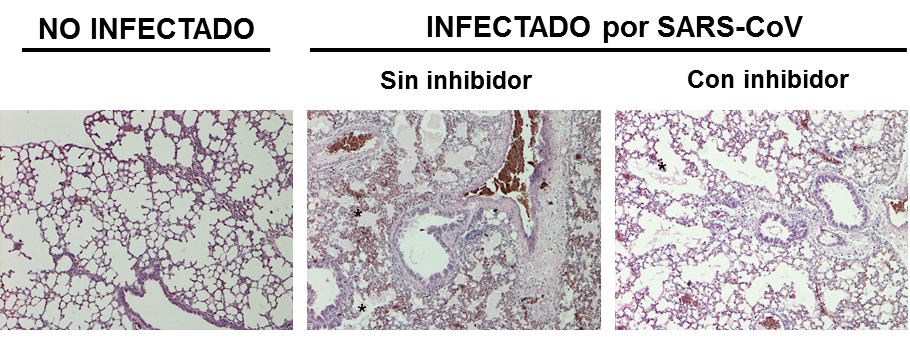Pequeñas moléculas de RNA contribuyen al daño pulmonar por el SARS