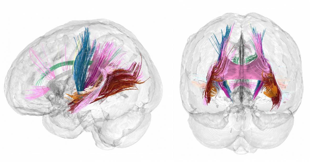 Los cambios en la materia gris y blanca del cerebro a lo largo de la gestación fueron visibles en las imágenes