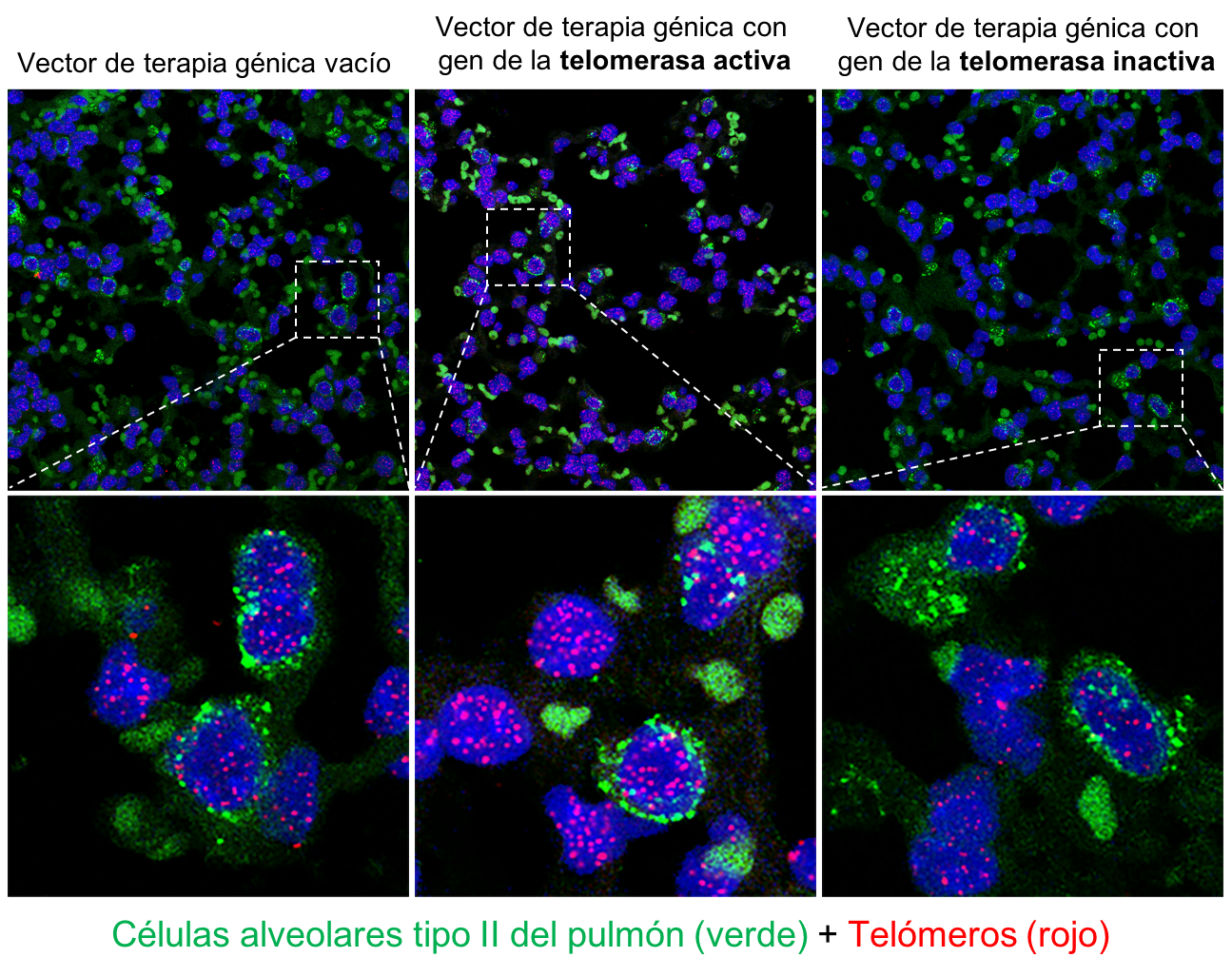 Pulmones tratados con los vectores de terapia génica con telomerasa