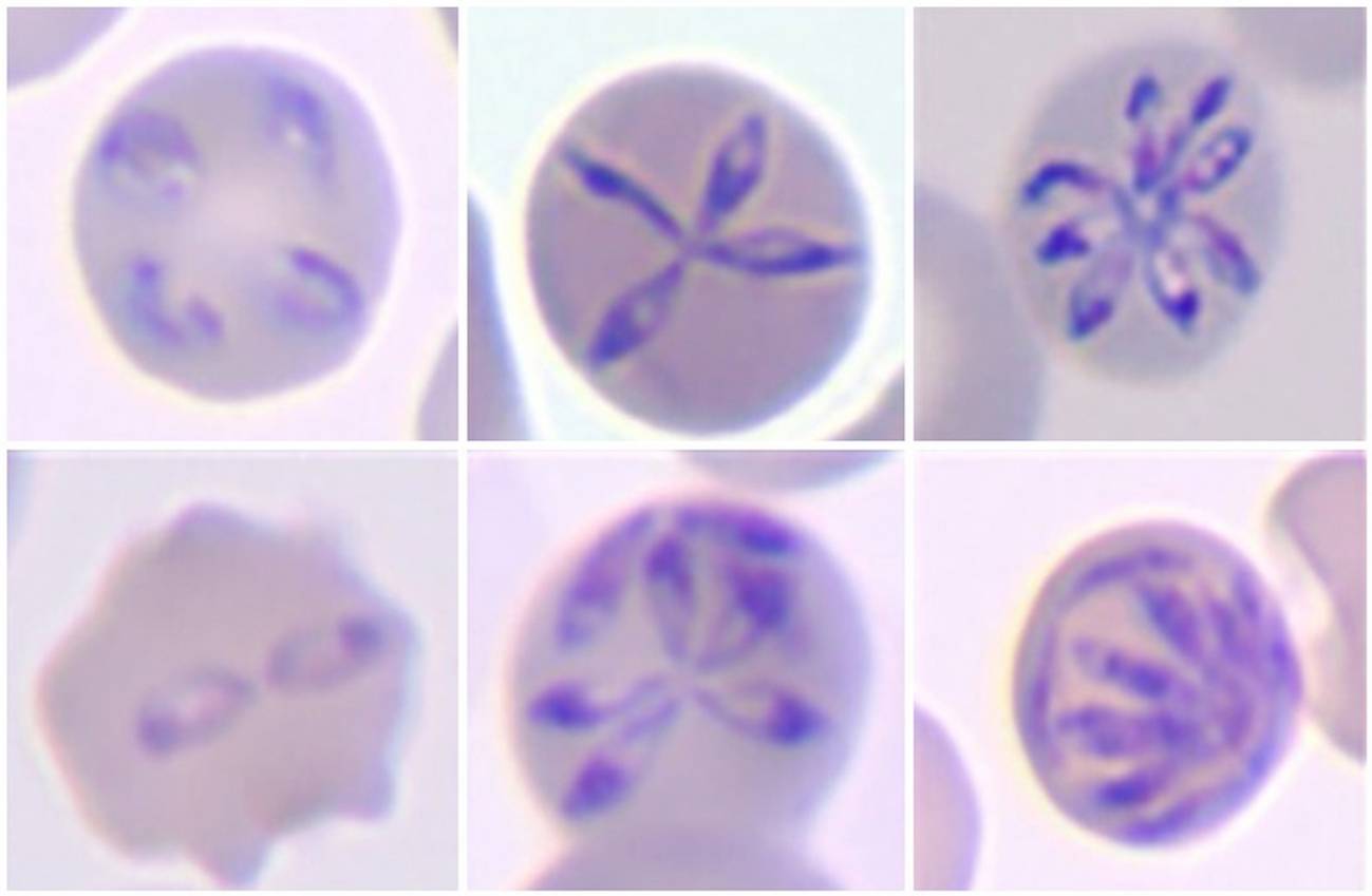 morfología de diversas etapas características del desarrollo de 'Babesia hegotelforum'