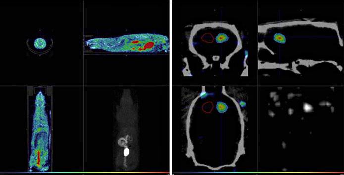 Imagen PET/CT (CNA)