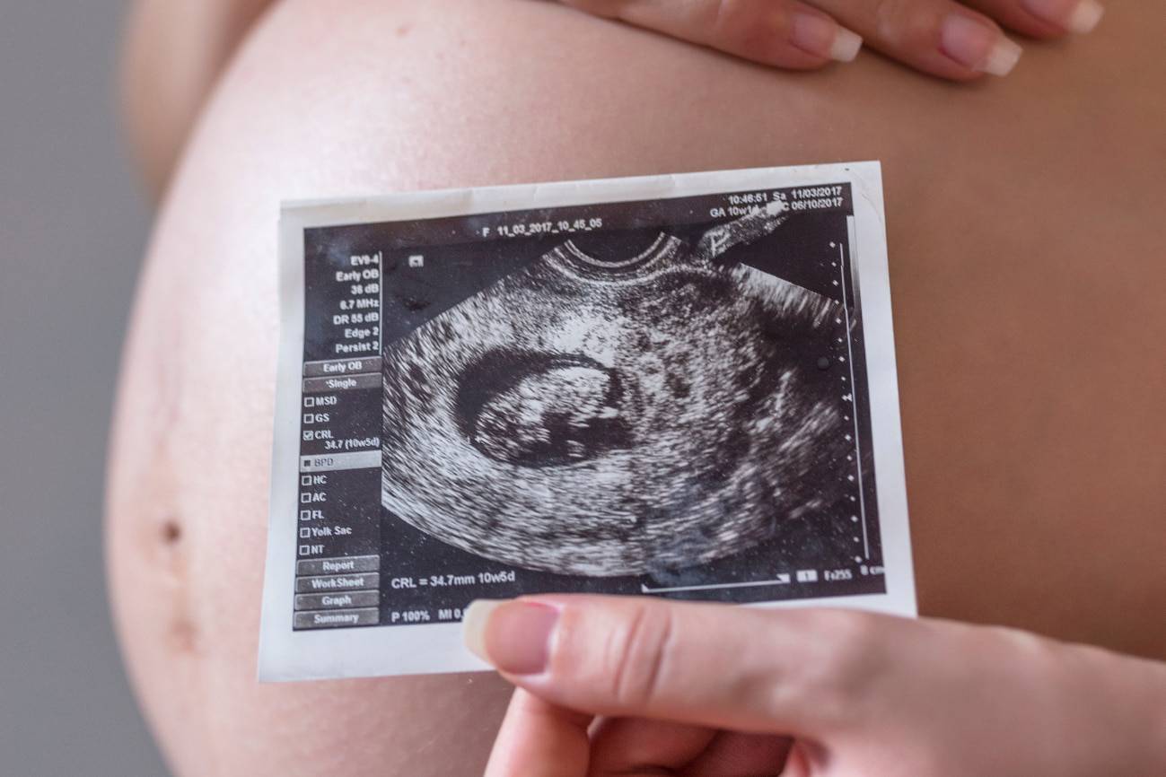 Mujer embarazada sostiene la foto de su bebé