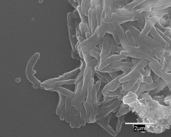 ¿Saben las bacterias tuberculosas distinguir entre las vacas y los humanos?