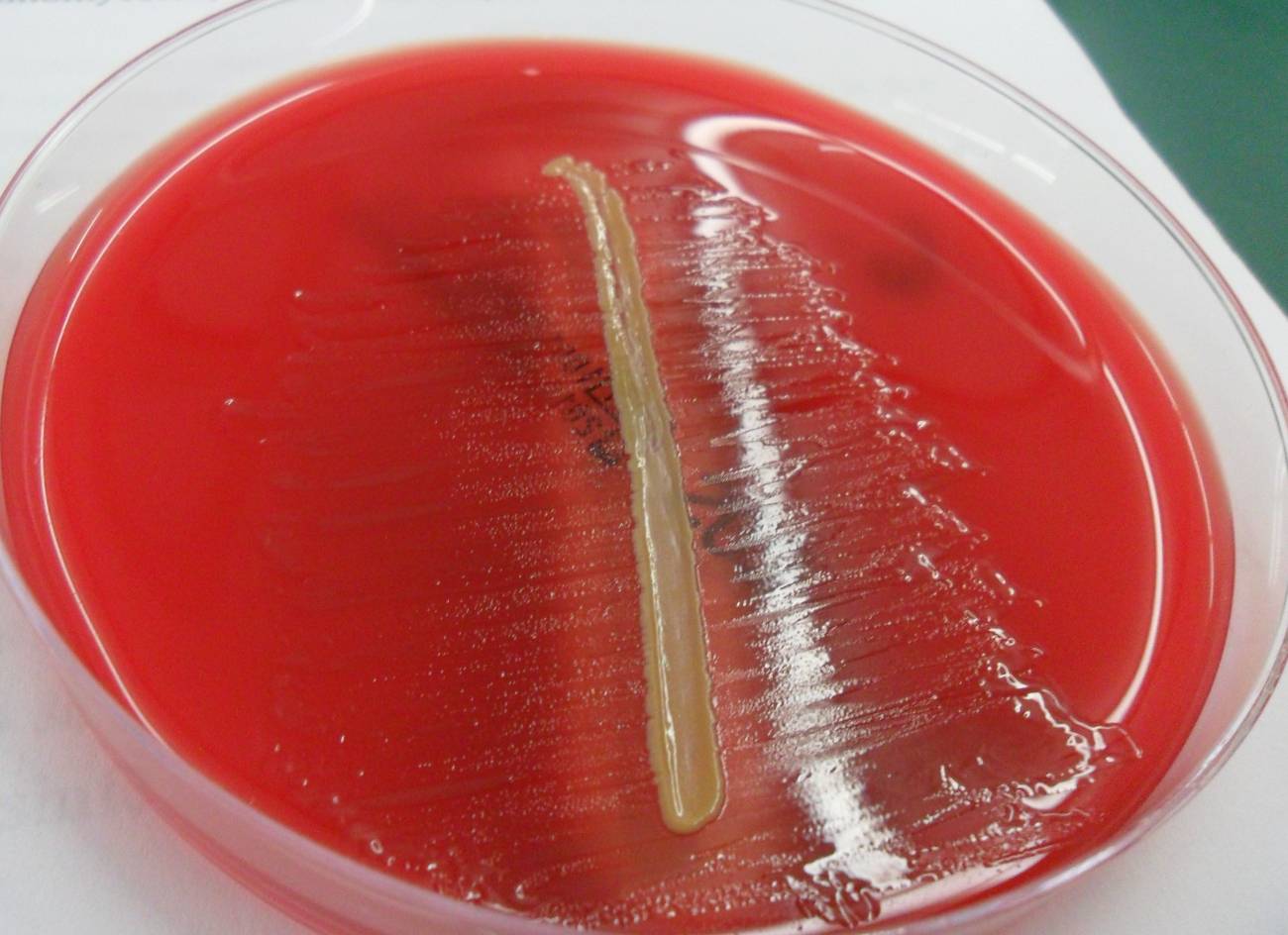 Terapias antibacterianas contra infecciones respiratorias