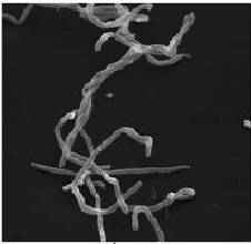 Transferencia horizontal de genes durante la evolución