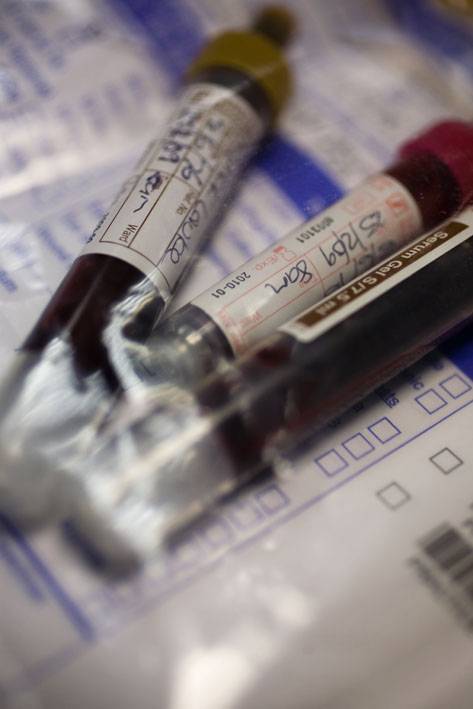Un algoritmo matemático ayuda a extraer más información de la sangre