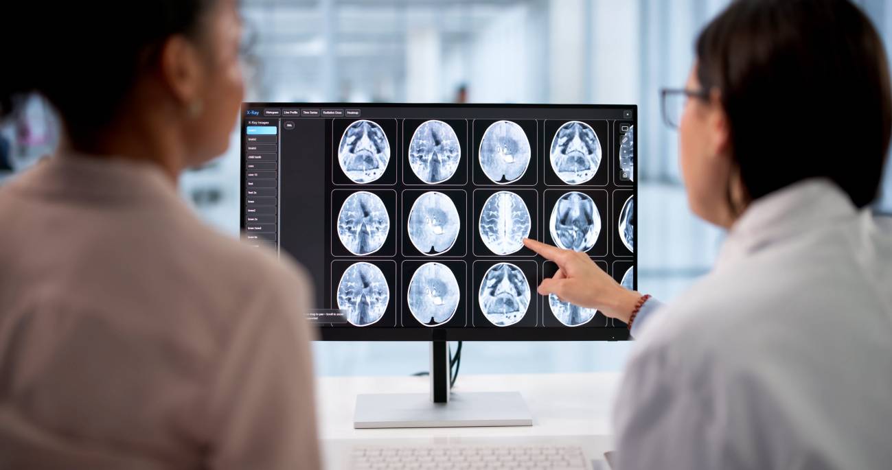 Un análisis de sangre y un nuevo escáner cerebral detectan señales de alzhéimer años antes de los síntomas