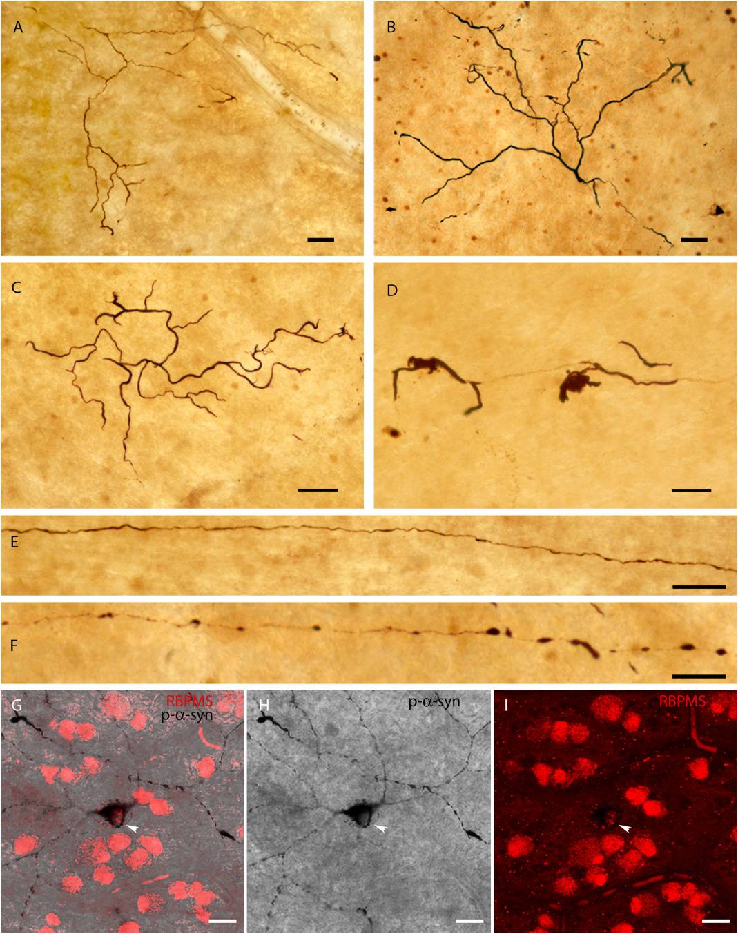 Figura estructuras inmunorreactivas en retinas