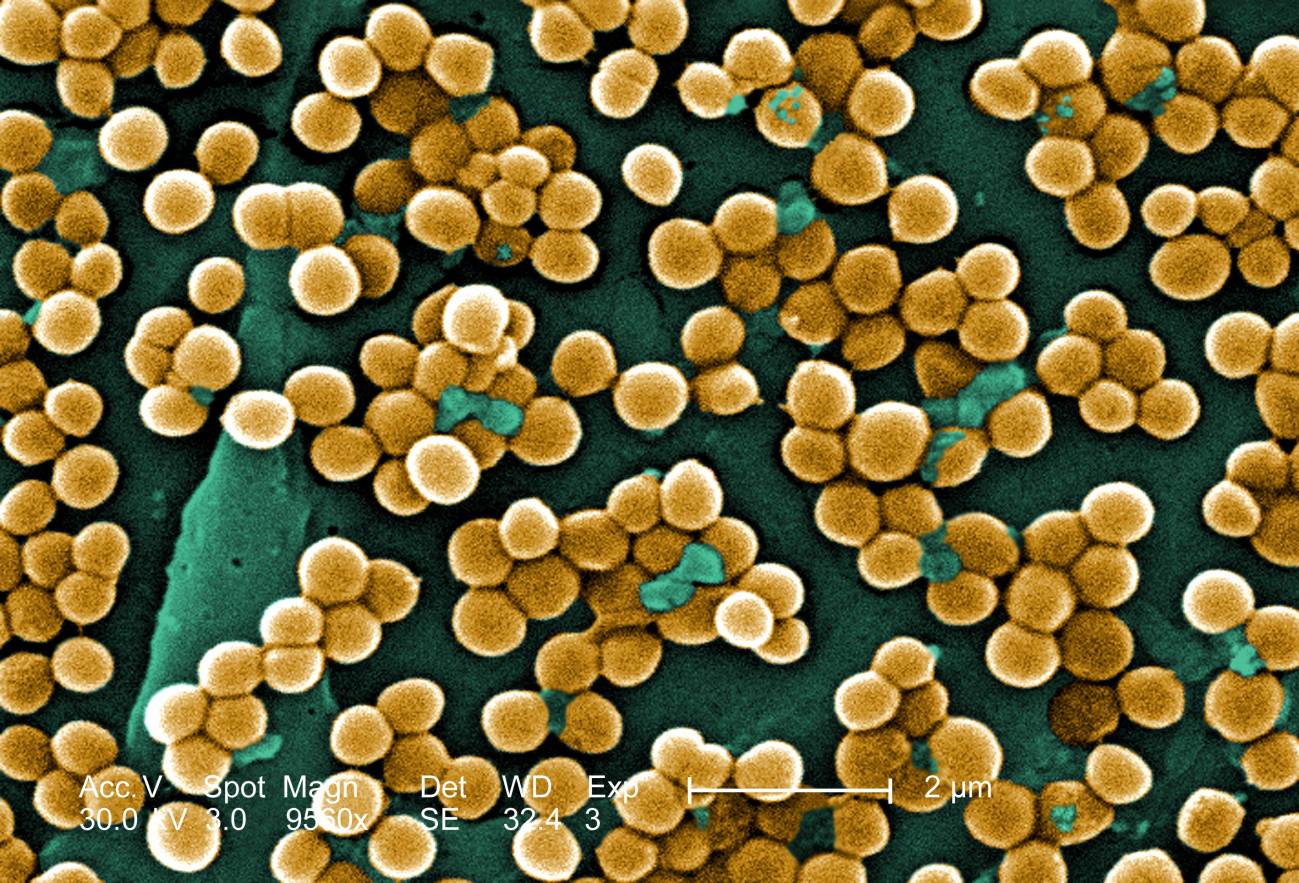 Un biosensor de grafeno para detectar el ‘Staphylococcus aureus’