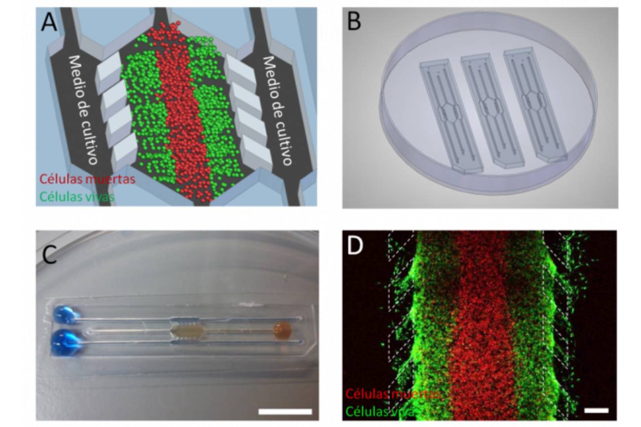 A) Esquema del dispositivo microfluídico. Las células tumorales son alojadas en la cámara central en combinación con una matriz proteica tridimensional. Posteriormente, se perfunde medio de cultivo por los canales laterales para proveer de oxígeno y nutrientes al sistema. B) Se pueden construir matrices con varios dispositivos pegados a una placa de Petri. C) Fotografía de un dispositivo en el que se han perfundido líquidos de distintos colores por los laterales y la cámara central. Escala 1 cm. D) Imagen de microscopía confocal del dispositvo. Tras 6 días en cultivo, las células de tumor cerebral (U-251 MG) se tiñeron con colorantes específicos para evaluar su viabilidad. Las células vivas aparecen en verde, mientras que las muertas aparecen en rojo. Los pilares que delimitan la frontera entre la cámara central y los canales laterales se han dibujado en línea blanca discontinua. Escala 400 µm.