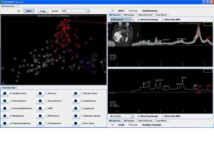 Software AIDTumour