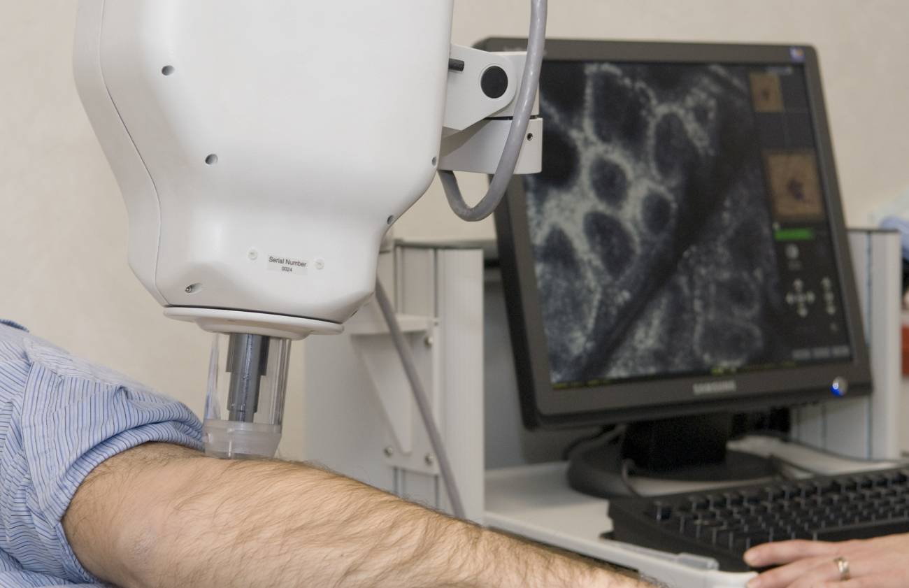 Un estudio identifica un oncogén que causa cáncer de piel y proliferación anormal de células madre