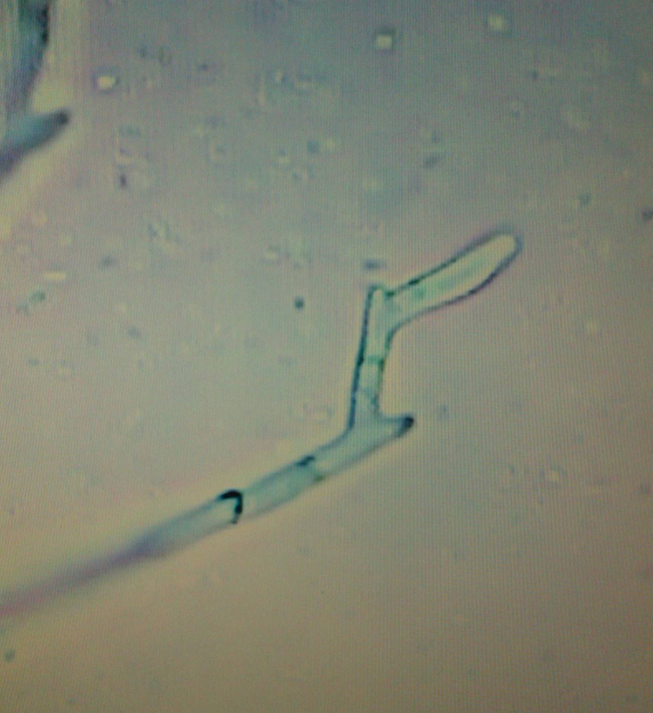 Investigadores del Campus de Palencia creen que el coleóptero ‘Tomicus piniperda’, una especie de barrenillo, contribuiría a dispersar ‘Fusarium circinatum’