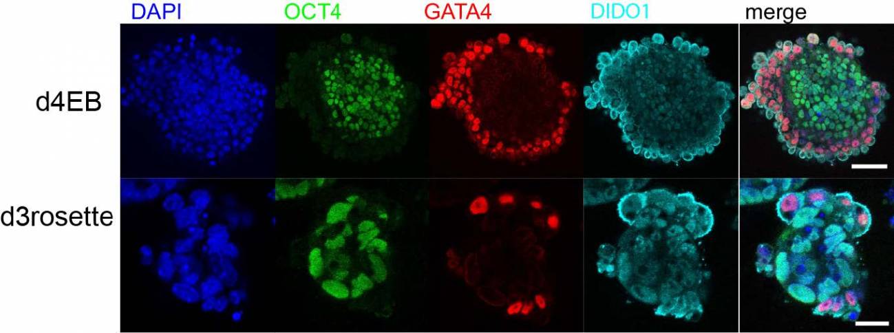 Un interruptor molecular indica a las células madre cuándo diferenciarse