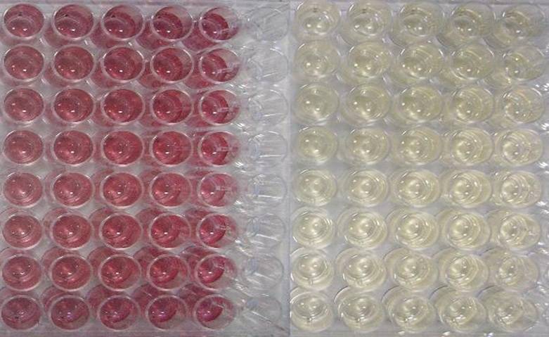 Microplaca para medir la actividad de la lipasa. Imagen: Fundación Descubre