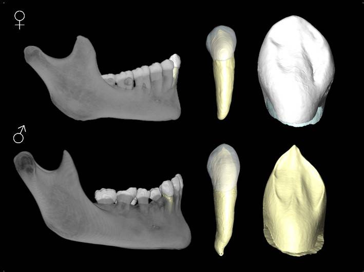 Un método forense identifica el sexo de restos humanos con una fiabilidad del 92%