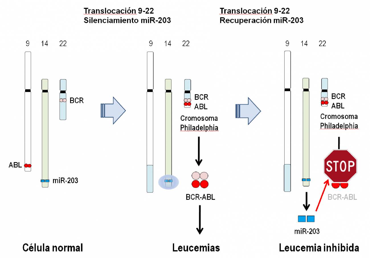 Un microRNA puede controlar el desarrollo de las leucemias causadas por el cromosoma Philadelphia